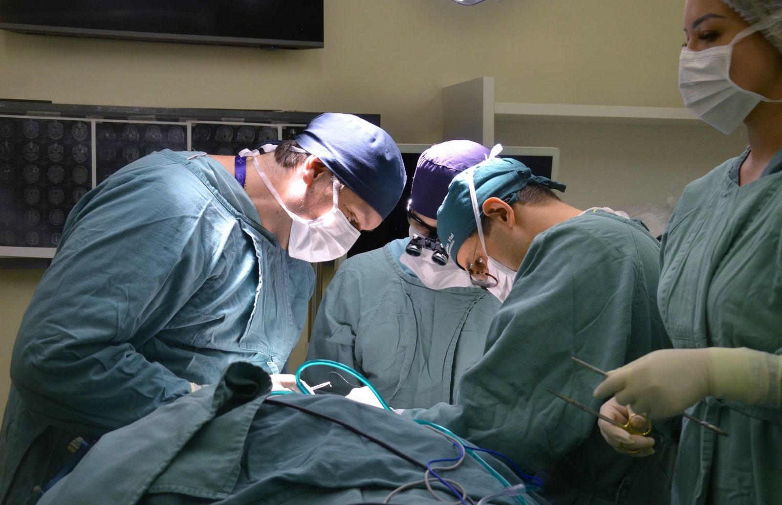 Santa Casa inova com abordagem transorbitária para tumores cerebrais