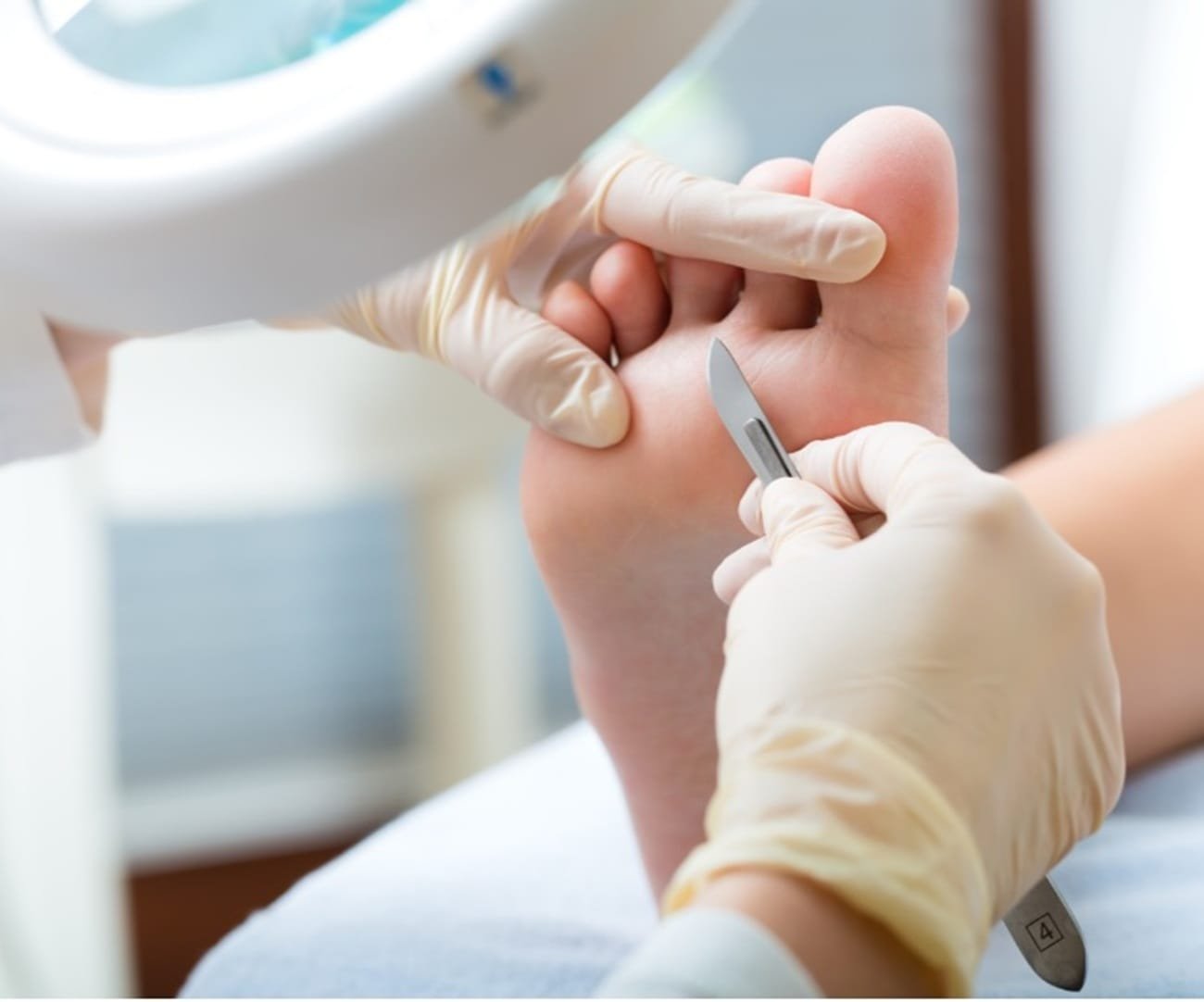 Cuidados podológicos em pacientes diabéticos: prevenção e manejo de complicações nos pés