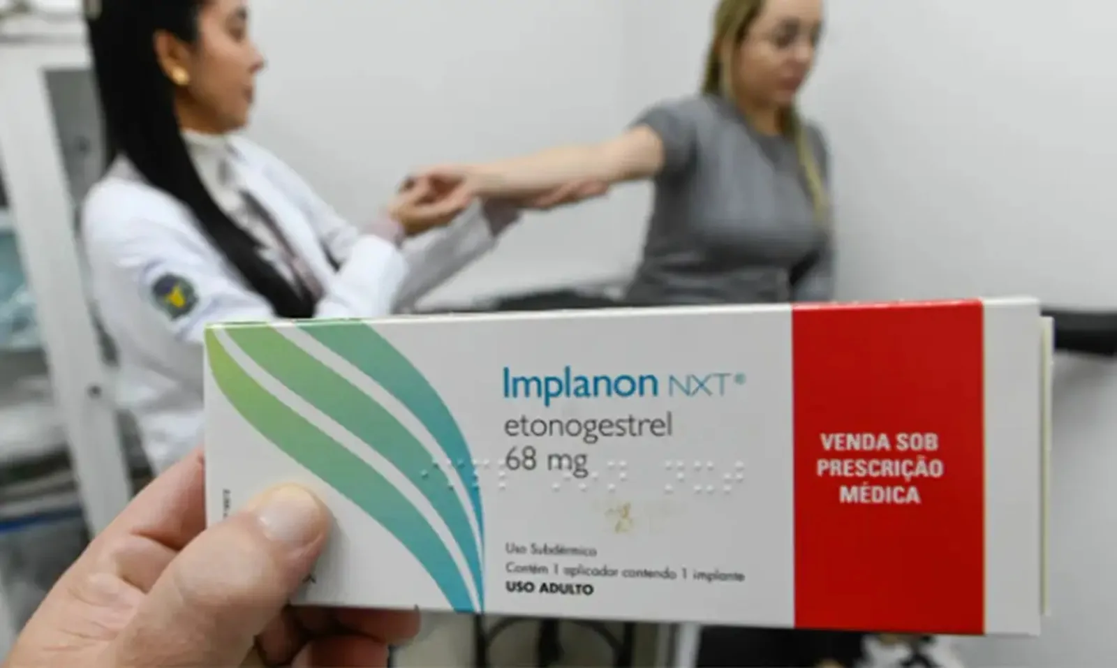 Prefeitura de Passo Fundo amplia acesso a métodos contraceptivos de longa duração 1 implanon